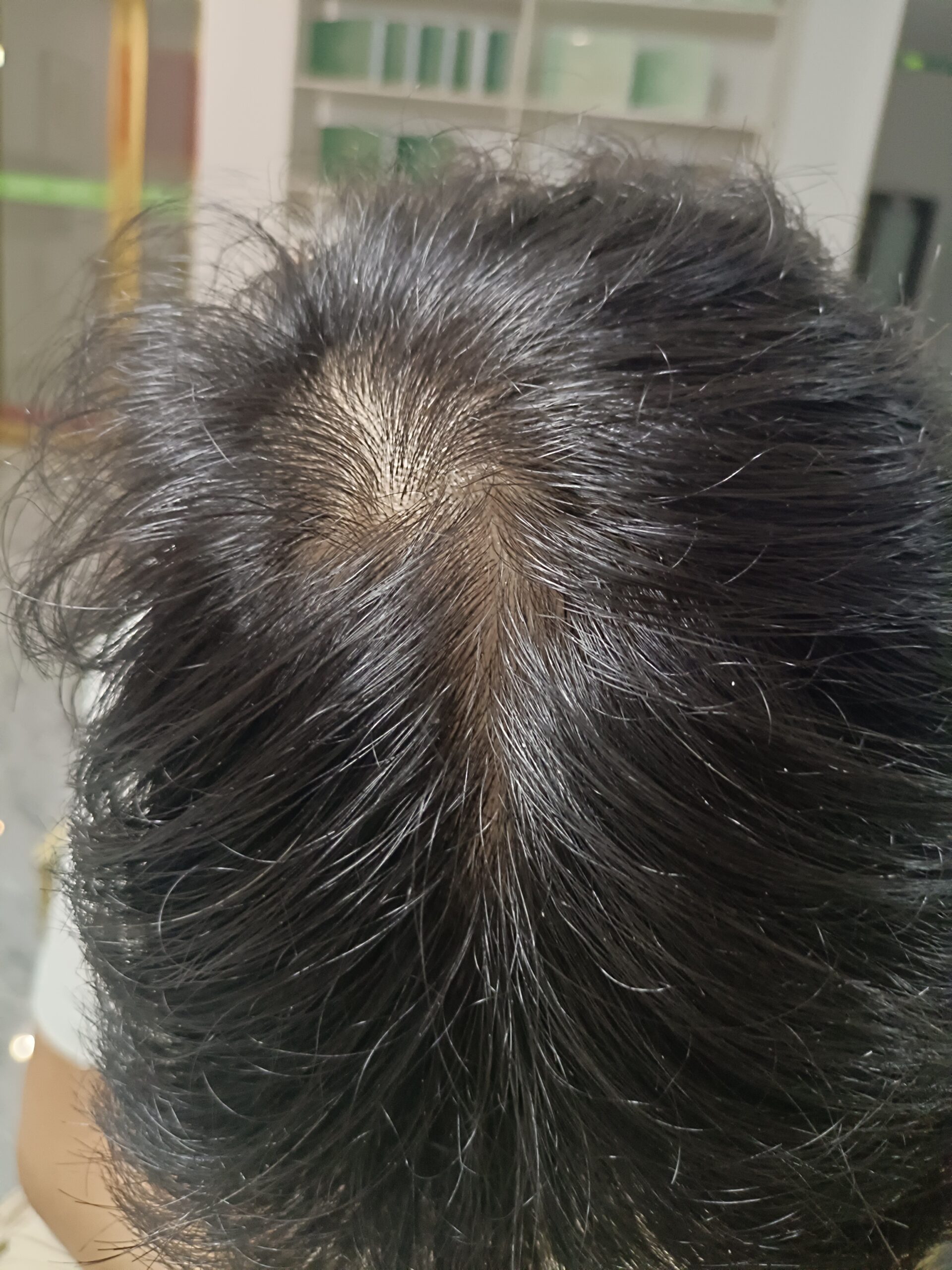 蒋念的健康改变故事